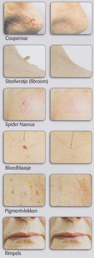 t-away2 mogelijkheden